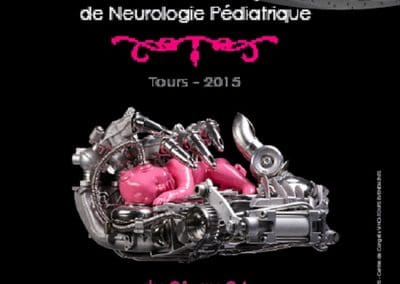 25ème Congrès de la Société Française de Neurologie Pédiatrique TOURS 2015