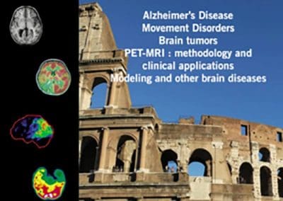5TH EUROPEAN CONFERENCE ON CLINICAL NEUROIMAGING (ECCN) ROME 2016