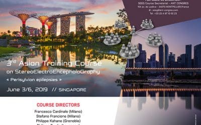 3RD ASIAN TRAINING COURSE ON STEREOELECTROENCEPHALOGRAPHY (SEEG) SINGAPORE